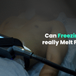 Cryolipolysis Treatment in Chennai