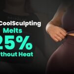 CoolSculpting in Chennai