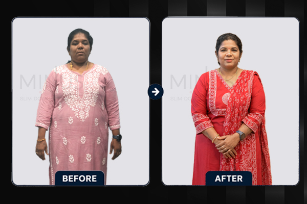 Minus Before and afterArtboard 2.jpg