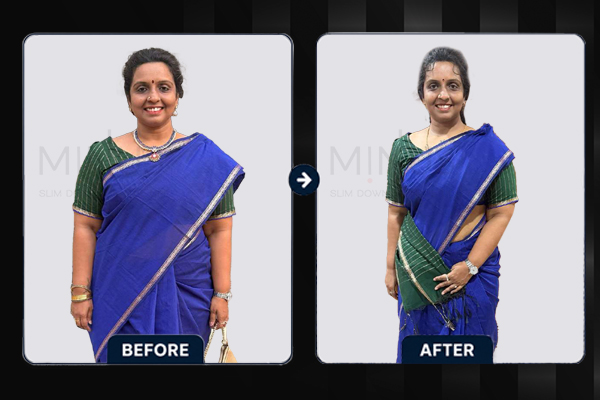 Minus Before and afterArtboard 4.jpg