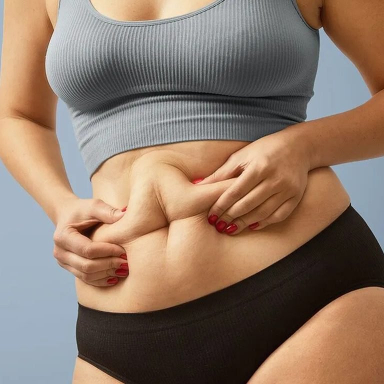 Abdominoplasty